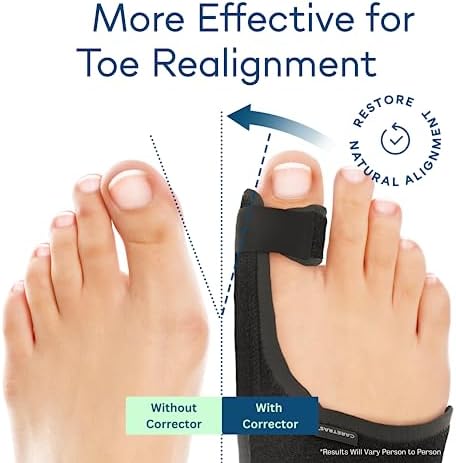Caretras Bunion Corrector, Orthopedic Bunion Splint, Big Toe Separator Pain - Image 2